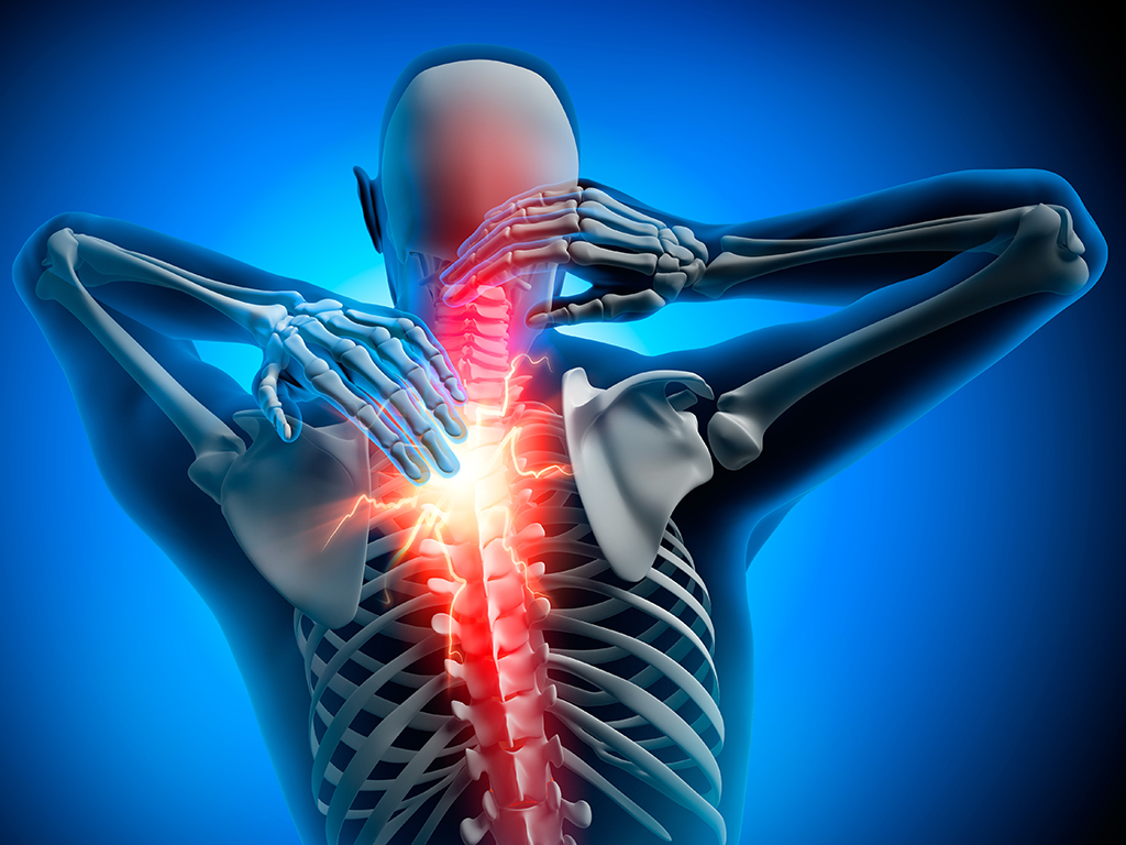 Spondylitis treatment