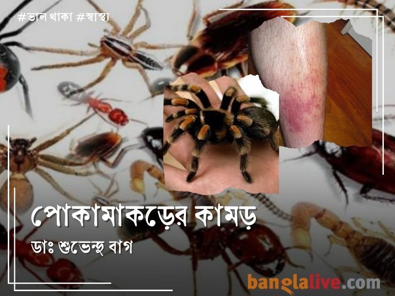 Health Article on Insect bite (4)